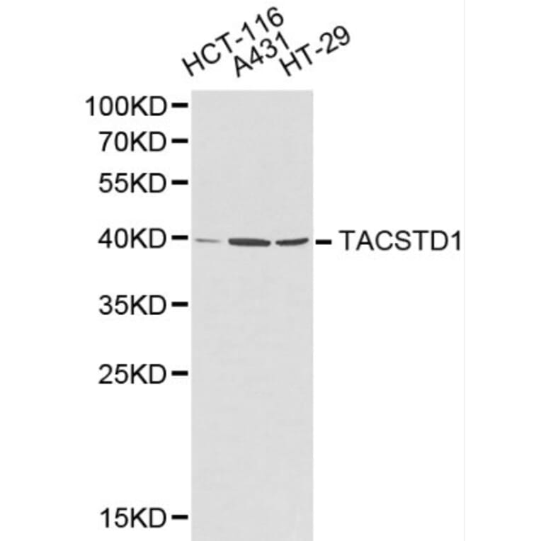 Anti-EPCAM Antibody from Bioworld Technology (BS6213) - Antibodies.com
