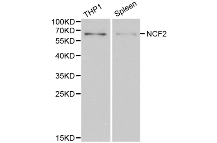Anti-NCF2 Antibody from Bioworld Technology (BS6214) - Antibodies.com