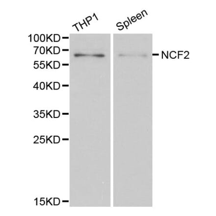 Anti-NCF2 Antibody from Bioworld Technology (BS6214) - Antibodies.com