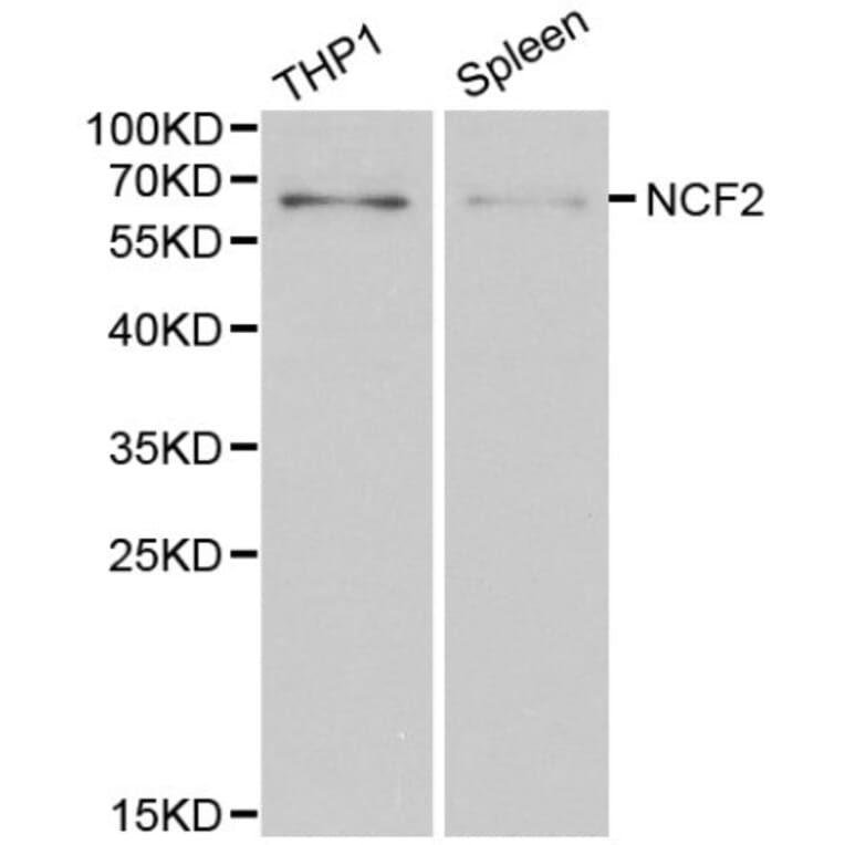 Anti-NCF2 Antibody from Bioworld Technology (BS6214) - Antibodies.com