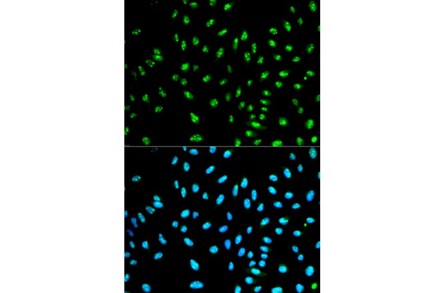 Anti-NCF2 Antibody from Bioworld Technology (BS6214) - Antibodies.com