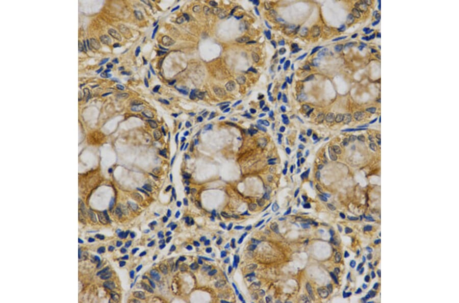 Anti-Maspin Antibody from Bioworld Technology (BS6215) - Antibodies.com