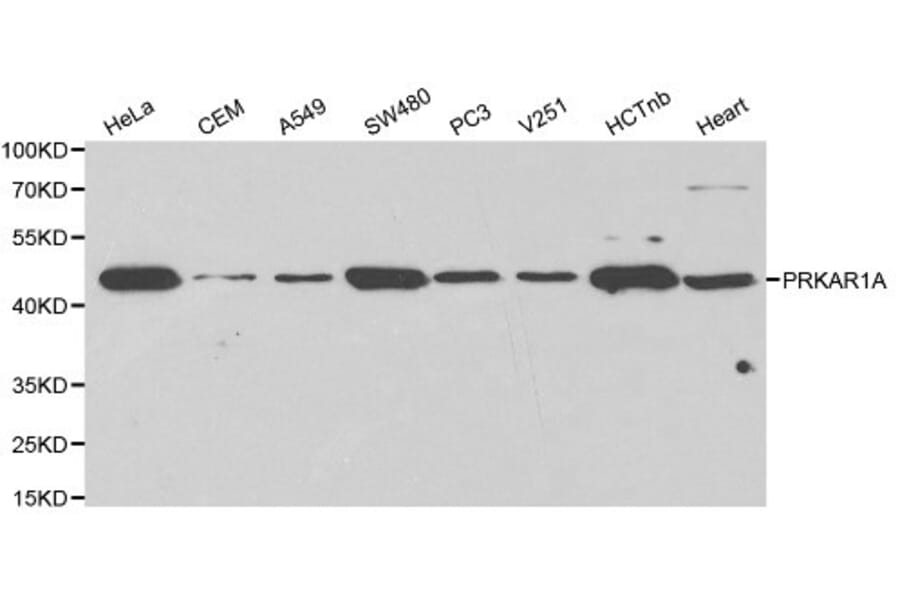 Anti-PKA Iα reg Antibody from Bioworld Technology (BS6217) - Antibodies.com