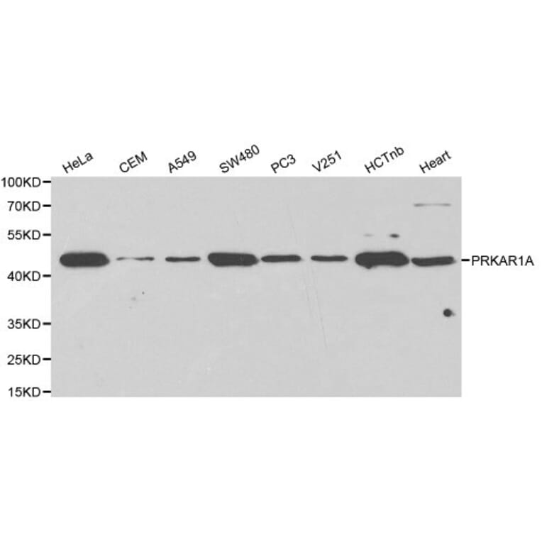 Anti-PKA Iα reg Antibody from Bioworld Technology (BS6217) - Antibodies.com