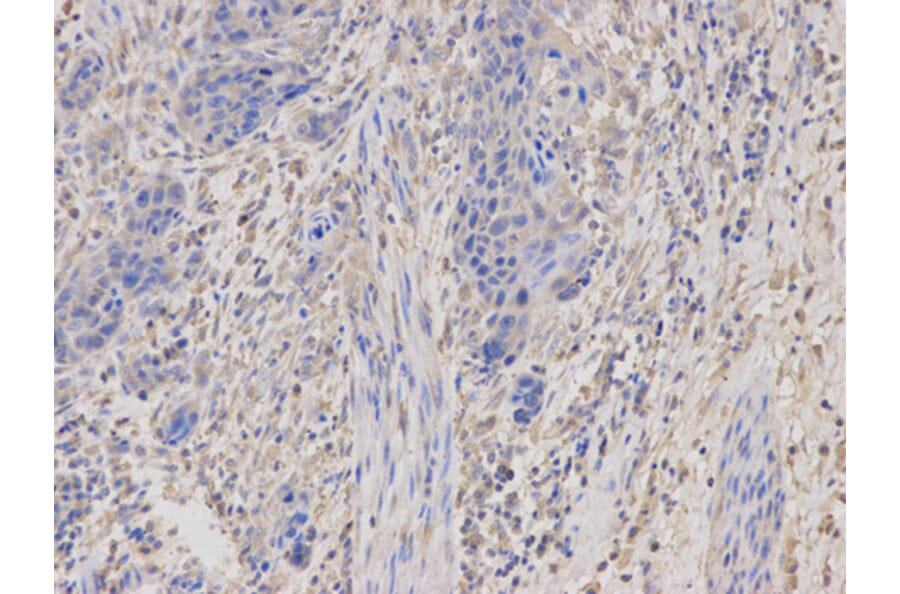 Anti-PKA Iα reg Antibody from Bioworld Technology (BS6217) - Antibodies.com