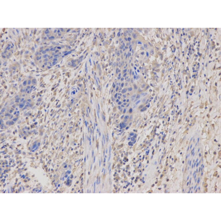 Anti-PKA Iα reg Antibody from Bioworld Technology (BS6217) - Antibodies.com