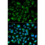 Anti-PKA Iα reg Antibody from Bioworld Technology (BS6217) - Antibodies.com