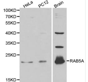 Anti-RAB5A Antibody from Bioworld Technology (BS6218) - Antibodies.com