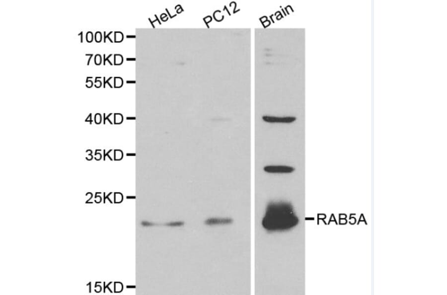 Anti-RAB5A Antibody from Bioworld Technology (BS6218) - Antibodies.com