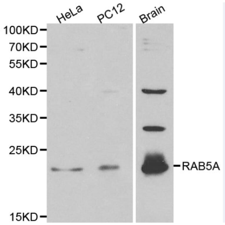 Anti-RAB5A Antibody from Bioworld Technology (BS6218) - Antibodies.com