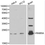 Anti-RAB5A Antibody from Bioworld Technology (BS6218) - Antibodies.com