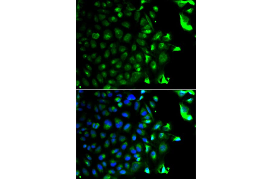 Anti-RAB5A Antibody from Bioworld Technology (BS6218) - Antibodies.com