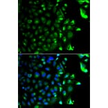 Anti-RAB5A Antibody from Bioworld Technology (BS6218) - Antibodies.com