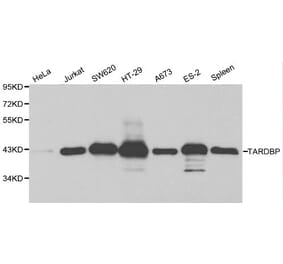 Anti-TARDBP Antibody from Bioworld Technology (BS6221) - Antibodies.com