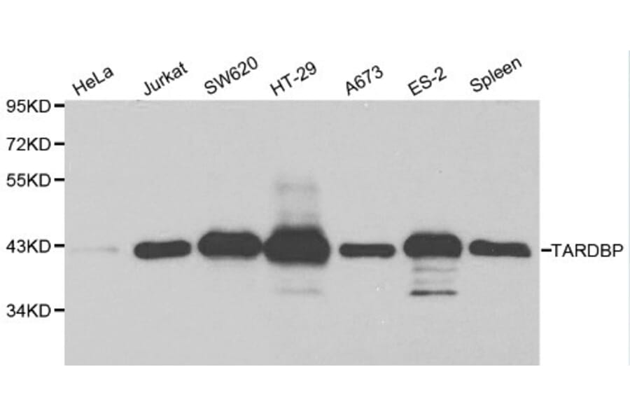 Anti-TARDBP Antibody from Bioworld Technology (BS6221) - Antibodies.com