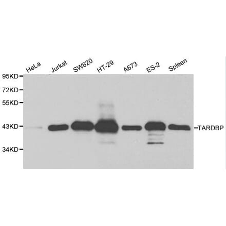 Anti-TARDBP Antibody from Bioworld Technology (BS6221) - Antibodies.com