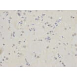 Anti-TARDBP Antibody from Bioworld Technology (BS6221) - Antibodies.com