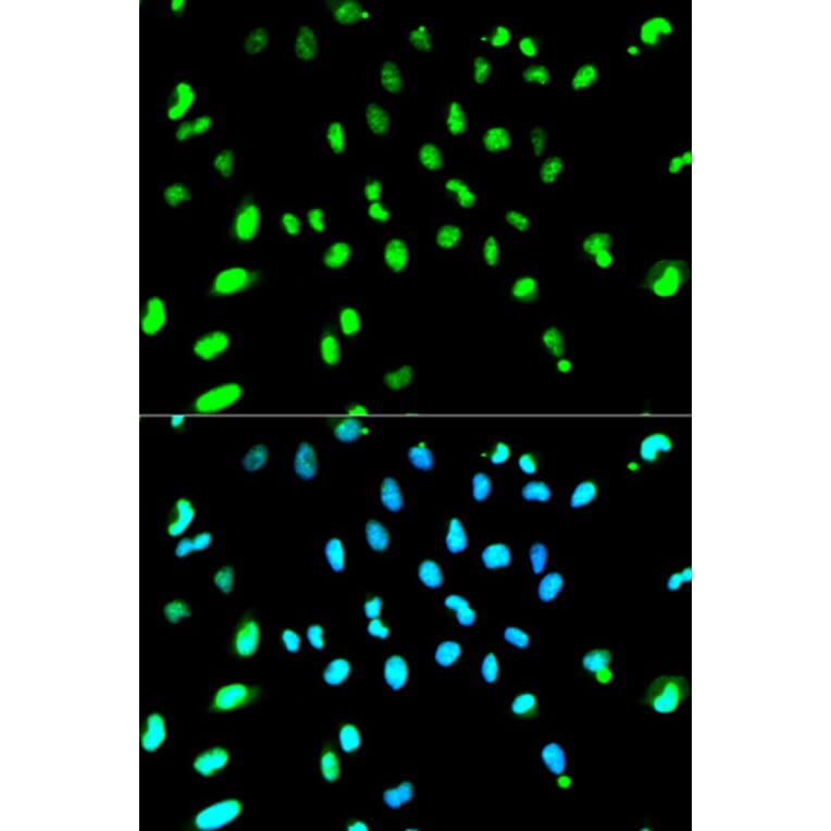 Anti-TARDBP Antibody from Bioworld Technology (BS6221) - Antibodies.com