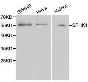 Anti-SPHK1 Antibody from Bioworld Technology (BS6222) - Antibodies.com
