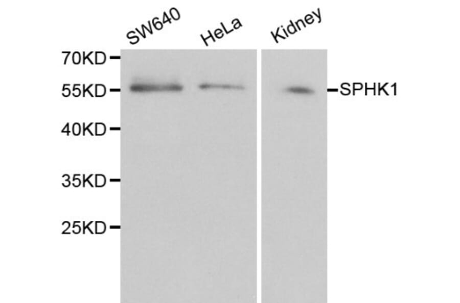 Anti-SPHK1 Antibody from Bioworld Technology (BS6222) - Antibodies.com