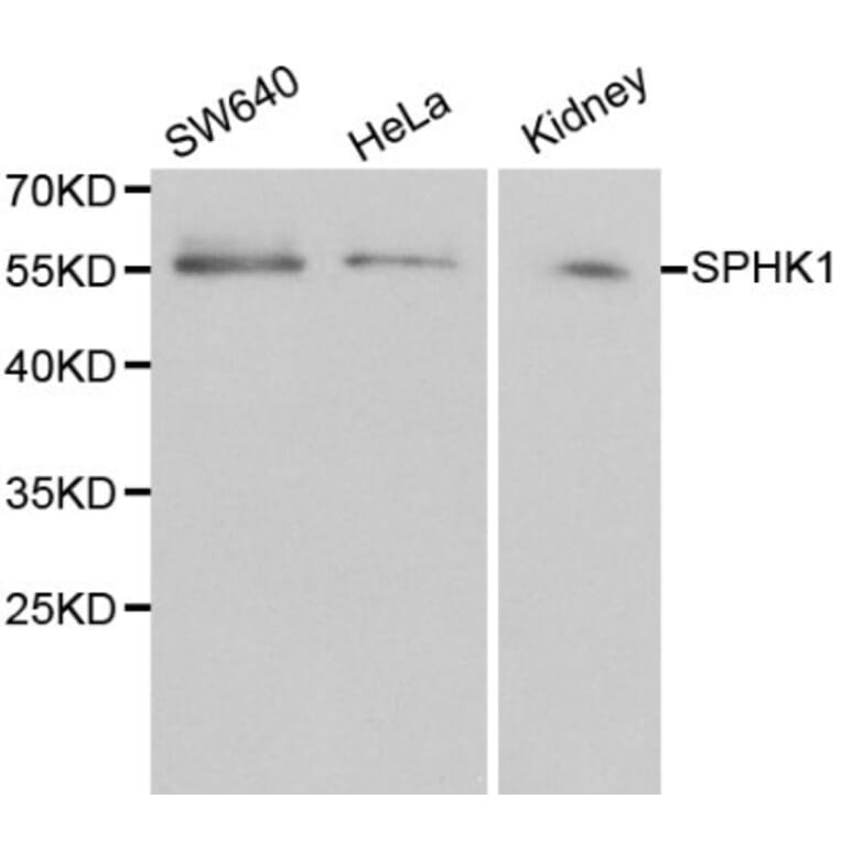 Anti-SPHK1 Antibody from Bioworld Technology (BS6222) - Antibodies.com