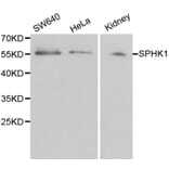 Anti-SPHK1 Antibody from Bioworld Technology (BS6222) - Antibodies.com