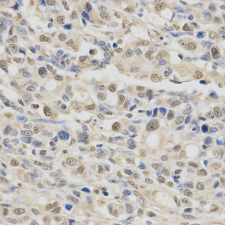 Anti-SPHK1 Antibody from Bioworld Technology (BS6222) - Antibodies.com