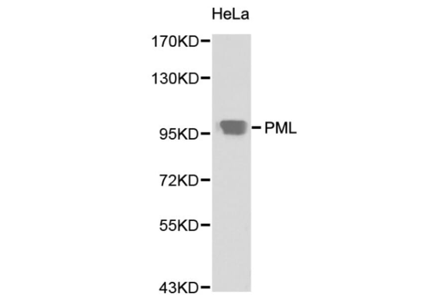 Anti-PML Antibody from Bioworld Technology (BS6223) - Antibodies.com