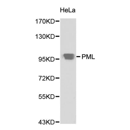 Anti-PML Antibody from Bioworld Technology (BS6223) - Antibodies.com