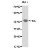 Anti-PML Antibody from Bioworld Technology (BS6223) - Antibodies.com