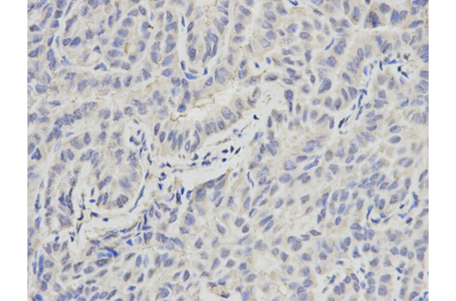 Anti-PML Antibody from Bioworld Technology (BS6223) - Antibodies.com