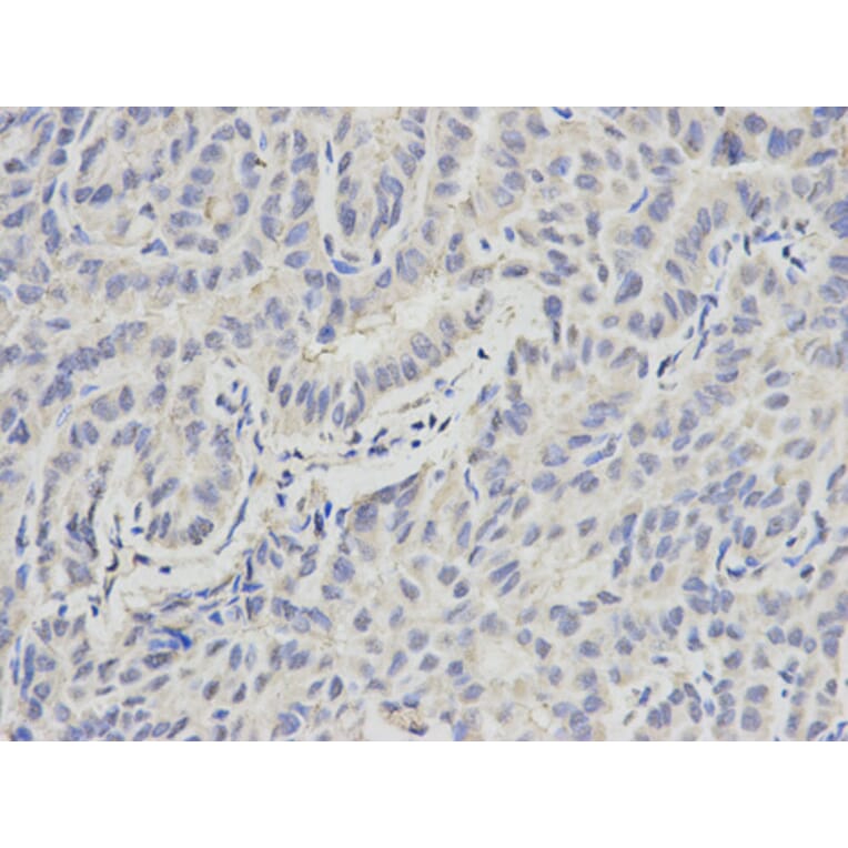 Anti-PML Antibody from Bioworld Technology (BS6223) - Antibodies.com