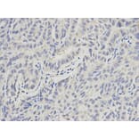 Anti-PML Antibody from Bioworld Technology (BS6223) - Antibodies.com