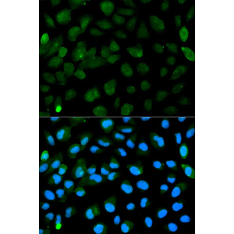 Anti-PML Antibody from Bioworld Technology (BS6223) - Antibodies.com