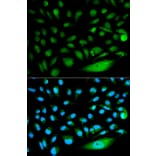 Anti-Smad1 Antibody from Bioworld Technology (BS6225) - Antibodies.com