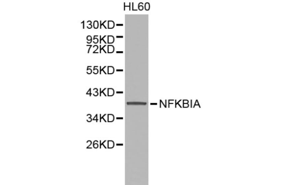 Anti-IkB-α/NFKBIA Antibody from Bioworld Technology (BS6227) - Antibodies.com
