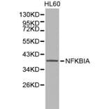 Anti-IkB-α/NFKBIA Antibody from Bioworld Technology (BS6227) - Antibodies.com