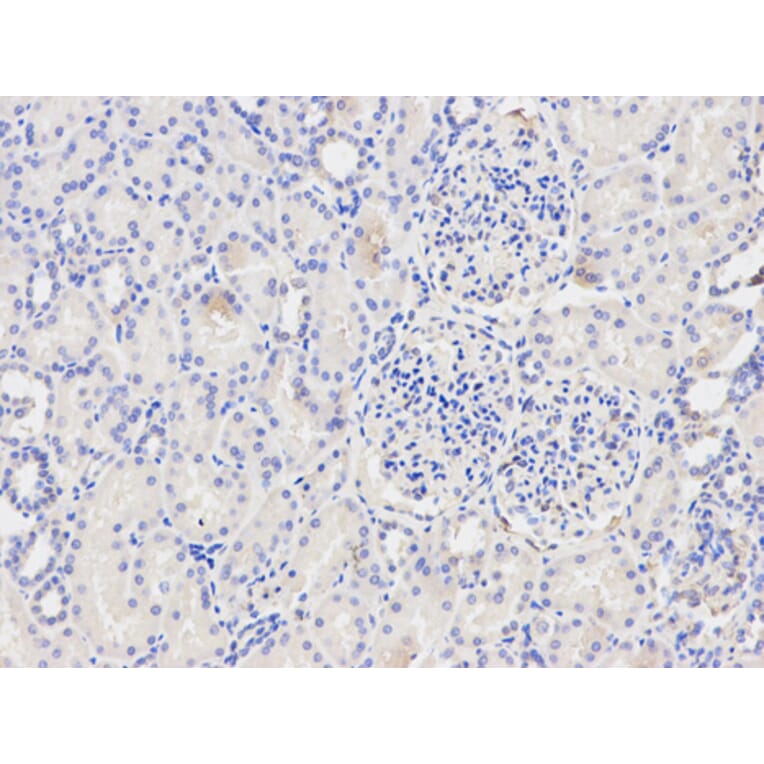 Anti-IkB-α/NFKBIA Antibody from Bioworld Technology (BS6227) - Antibodies.com