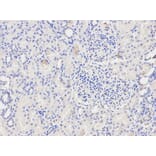 Anti-IkB-α/NFKBIA Antibody from Bioworld Technology (BS6227) - Antibodies.com