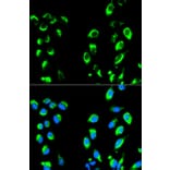 Anti-IkB-α/NFKBIA Antibody from Bioworld Technology (BS6227) - Antibodies.com