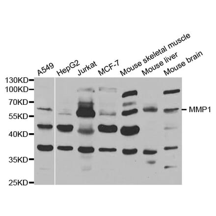 Anti-MMP-1 Antibody from Bioworld Technology (BS6232) - Antibodies.com