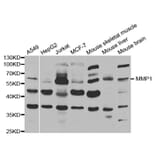 Anti-MMP-1 Antibody from Bioworld Technology (BS6232) - Antibodies.com