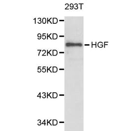 Anti-HGF Antibody from Bioworld Technology (BS6234) - Antibodies.com
