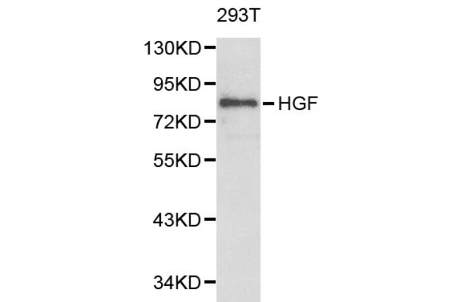 Anti-HGF Antibody from Bioworld Technology (BS6234) - Antibodies.com