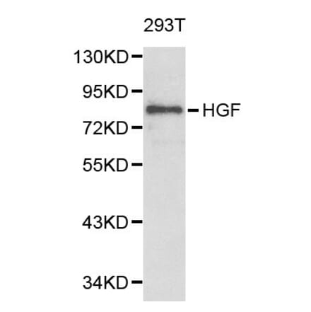 Anti-HGF Antibody from Bioworld Technology (BS6234) - Antibodies.com