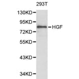 Anti-HGF Antibody from Bioworld Technology (BS6234) - Antibodies.com