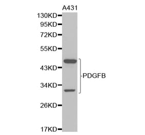 Anti-PDGFB Antibody from Bioworld Technology (BS6236) - Antibodies.com