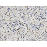 Anti-PDGFB Antibody from Bioworld Technology (BS6236) - Antibodies.com