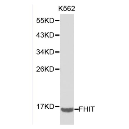 Anti-FHIT Antibody from Bioworld Technology (BS6237) - Antibodies.com