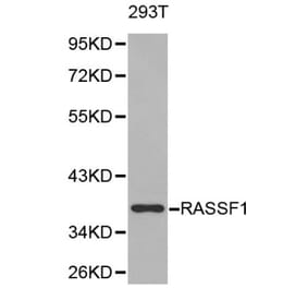 Anti-RASSF1 Antibody from Bioworld Technology (BS6244) - Antibodies.com